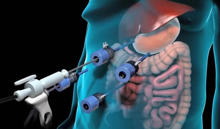 Medikal Animasyon - Nev Dijital Medya